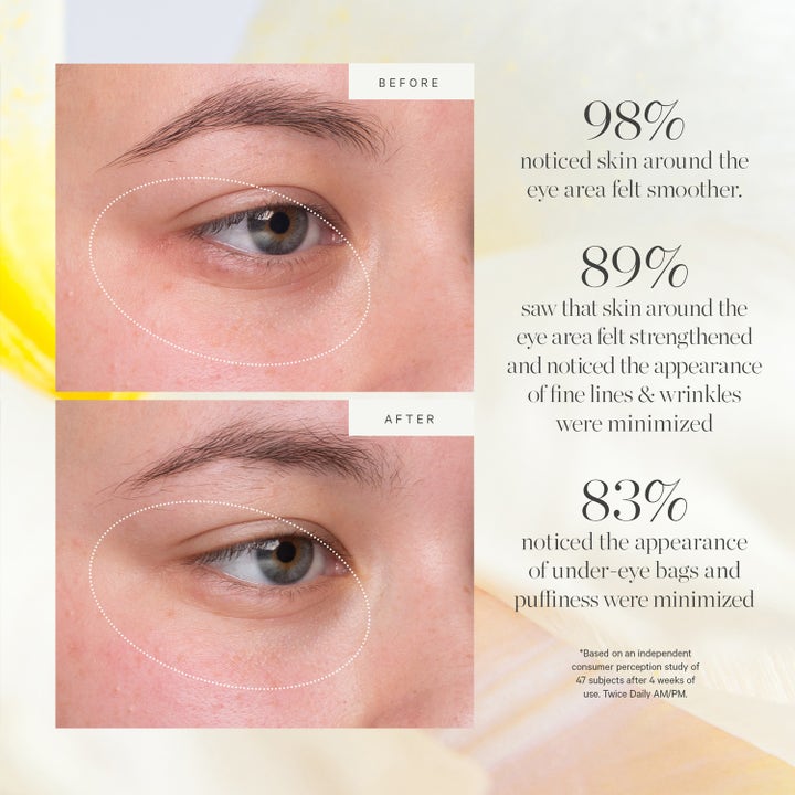 KORA Organics Kakadu Plum Vitamin C Eye Cream 15 ml visar före och efter resultat på fina linjer.