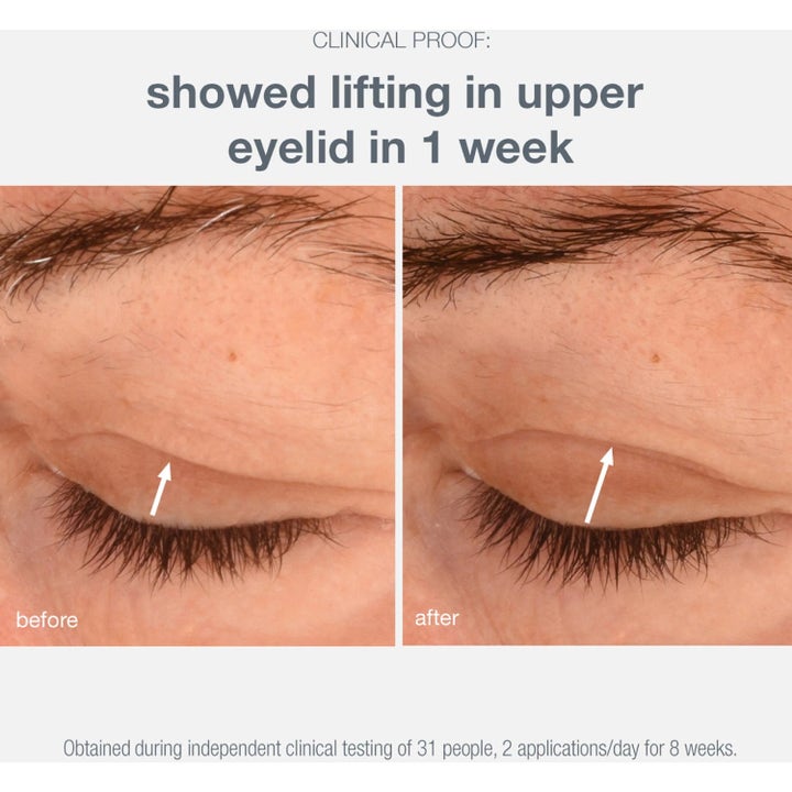 Dermalogica Phyto Nature Lifting Eye Cream Duo lyftande ögonkräm visar resultat på ögonlock efter en vecka.
