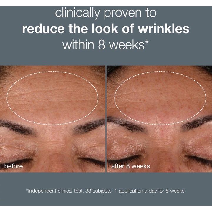 Dermalogica Dynamic Skin Recovery Duo SPF50 hudvård som ger synligt färre rynkor i pannan efter åtta veckor