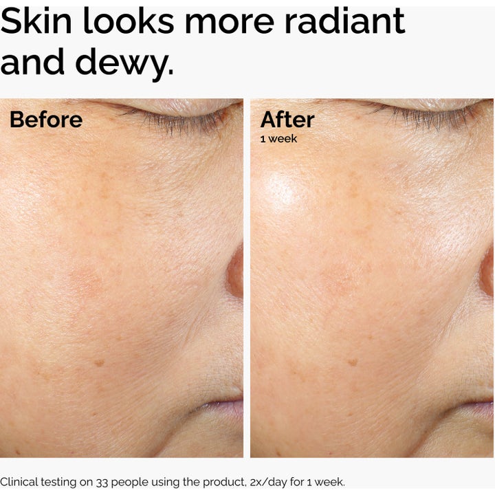 The Ordinary Rice Lipids + Ectoin Microemulsion 60 ml före och efter bild som ger huden lyster och fukt.
