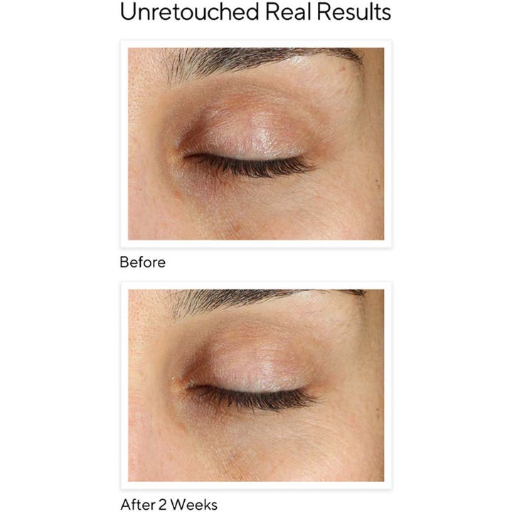 Murad Environmental Shield Vita-C Eyes 15 ml korrigerande ögonkräm mörka ringar visar före och efter resultat.