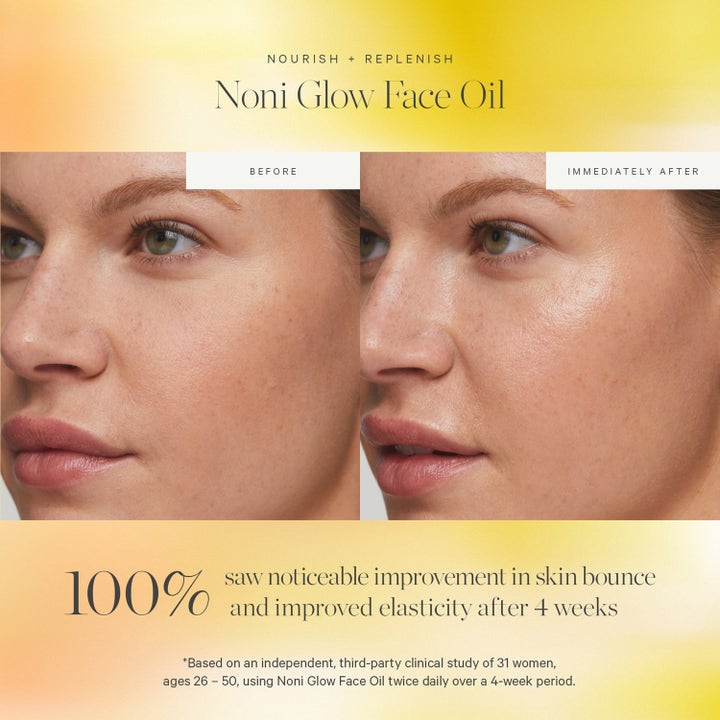 KORA Organics Noni Glow Face Oil 10 ml ger lyster i en före och efter-bild som visar ökad spänst och glans.