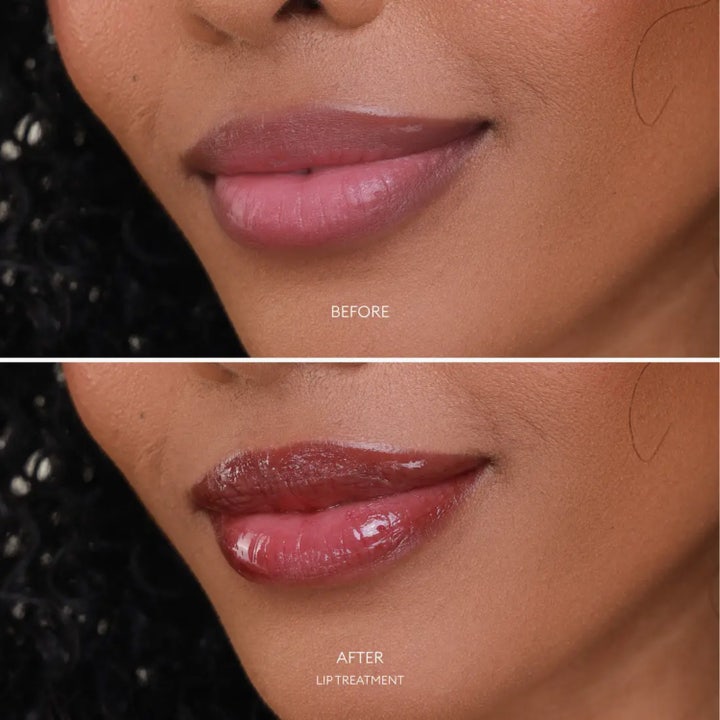 Lip Treatment Hydrating Lip Balm