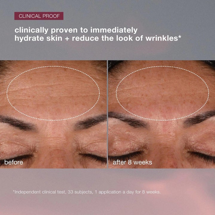Dermalogica Dynamic Skin Recovery och Retinol Serum 80 ml antiaging dagkräm och serum före och efter minskade rynkor