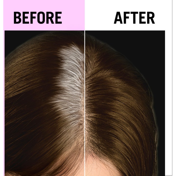 Root Retoucher
