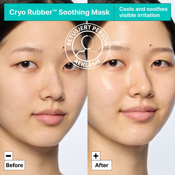 Dr.Jart+ Cryo Rubber Soothing Mask 36 g ansiktsmask visar före och efter resultat som svalkar och lugnar irritation