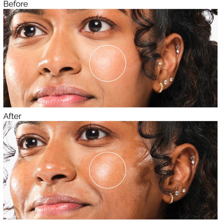 The Ordinary UV Filters SPF45 Serum 60 ml högskyddande solskydd ansikte som ger lyster i en före- och efterbild.